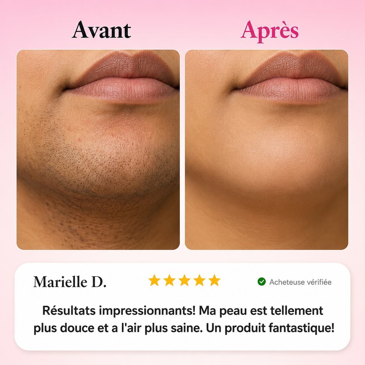 OyaPure™ Crème dépilatoire instantanée